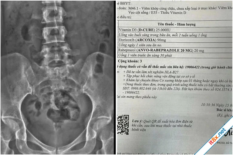 Cái giá của lối sống 'còn trẻ thì phải cày'